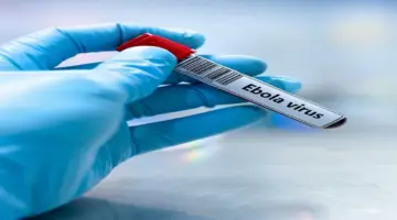 «إدارة الأزمات» و«الصحة» تتابعان مستجدات فيروس «إيبولا»