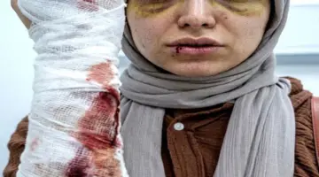 الطبيبة المعتدى عليها بشبرا الخيمة تتهم شقيق المريضة بهتك عرضها.. وتجديد حبسه 15 يومًا